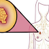 Here are the 6 Nutritious Foods That Can Destroy Breast Cysts Naturally