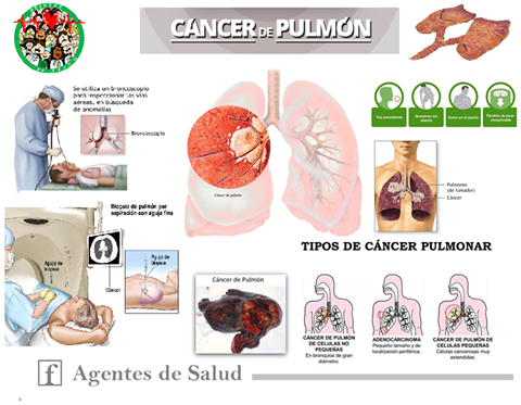 Prevenir cancer de pulmon
