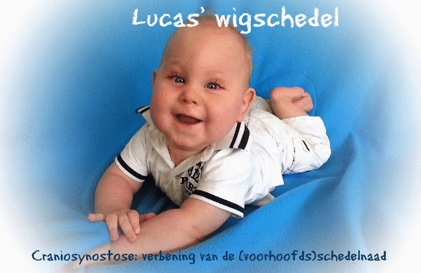 Lucas' wigschedel