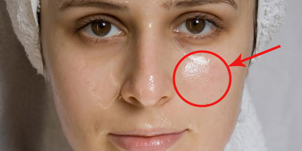 Cara Merawat Kulit Wajah Kusam Bruntusan Bertekstur Cara Merawat Kulit Wajah Kusam Bruntusan Bertekstur