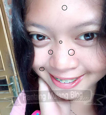 Cara Menghilangkan Jerawat Menggunakan Photoshop Cara Menghilangkan Jerawat Menggunakan Photoshop