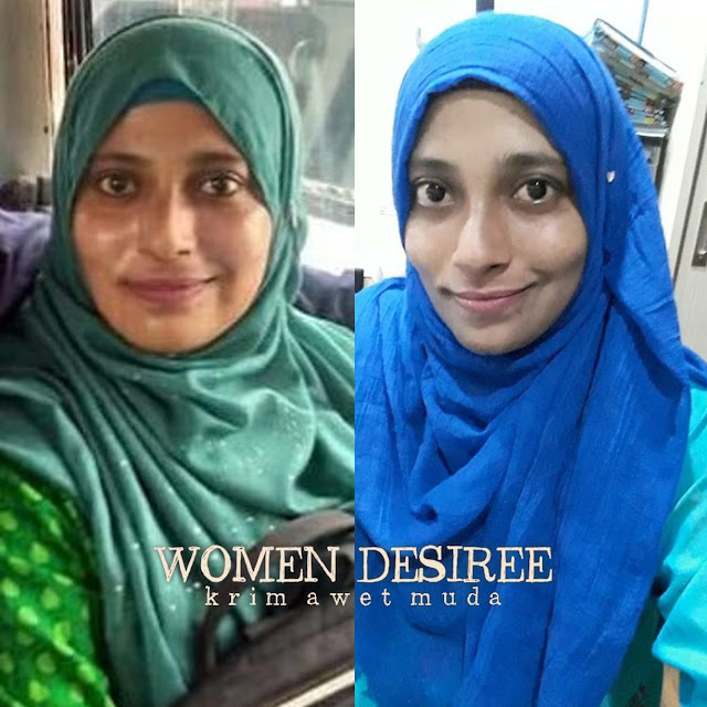 Krim WD meresap ke bawah kulit dan terus bertindak. ainaa_serum