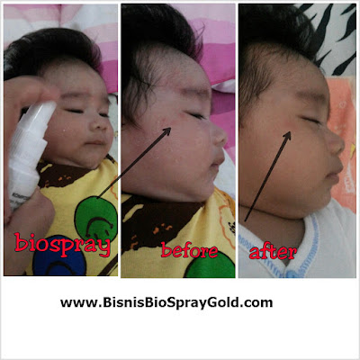Testimoni MSI Bio Spray - Multy Spray Testimoni MSI Bio Spray, Testimoni MSI Multy Spray