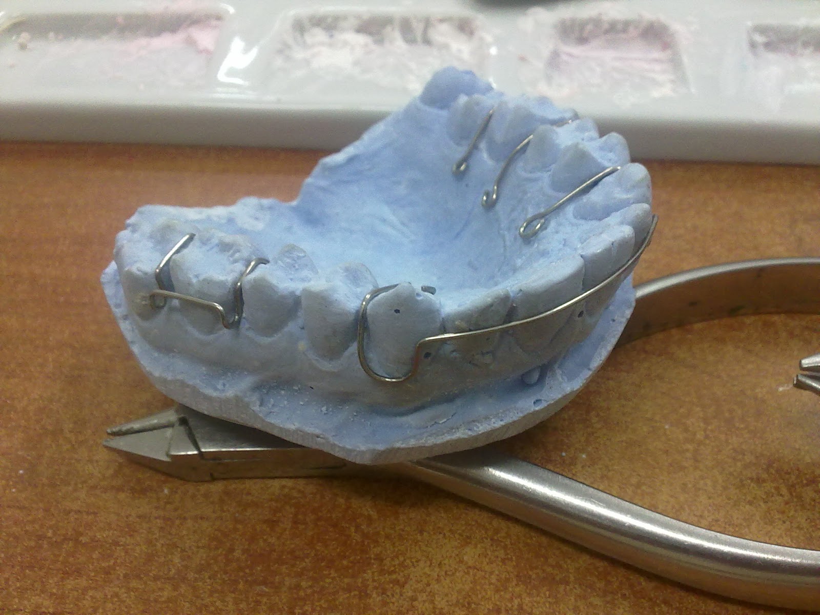 جهاز التثبيت (retainer) Smile maker