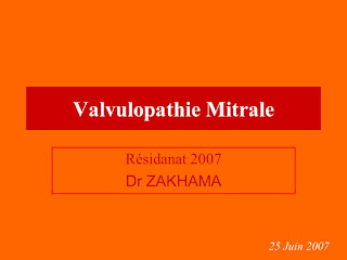 Valvulopathie Mitrale .pdf