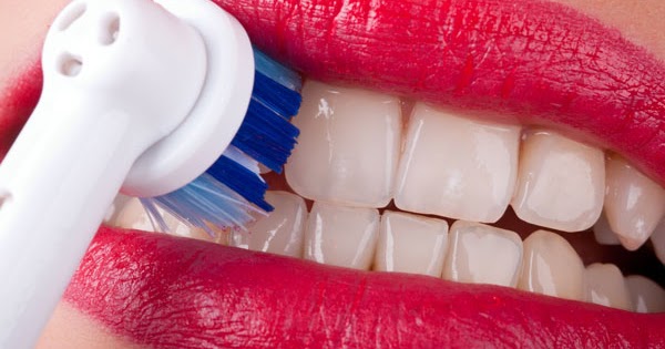 Como limpiar los implantes dentales
