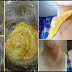 Remove Those Ugly Dark Patches On The Neck, Underarms And Inner Thighs In 15 Minutes
