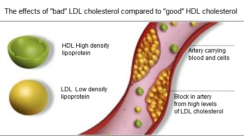 cara alami mengatasi hiperkolesterolemia