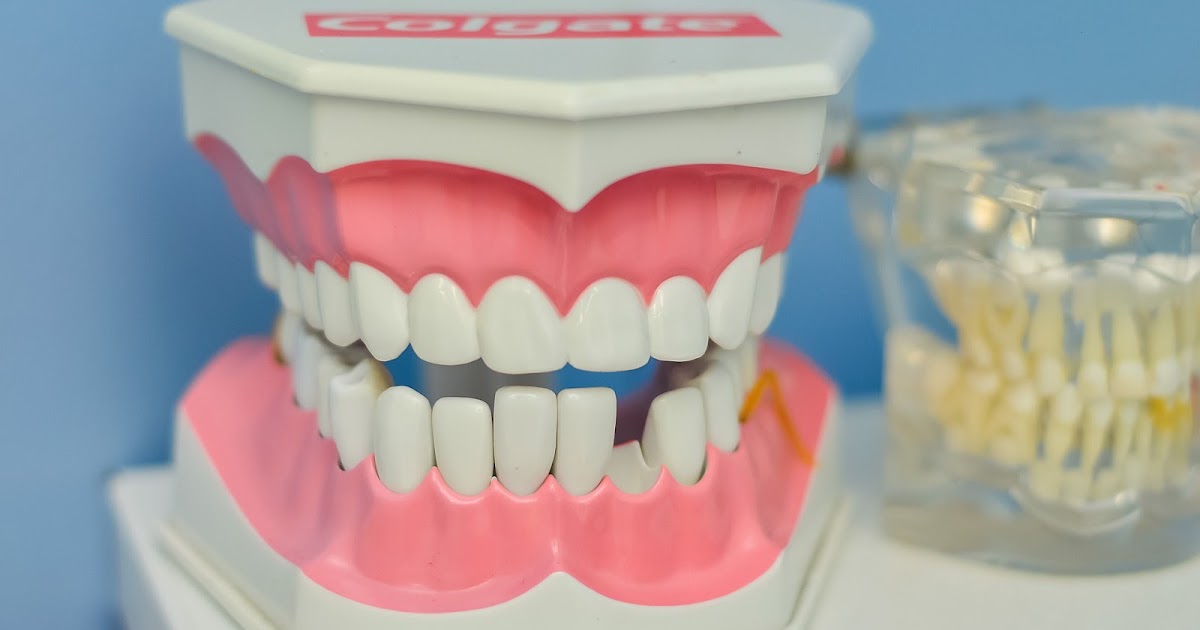 Tooth Abscess First aid and Treatment