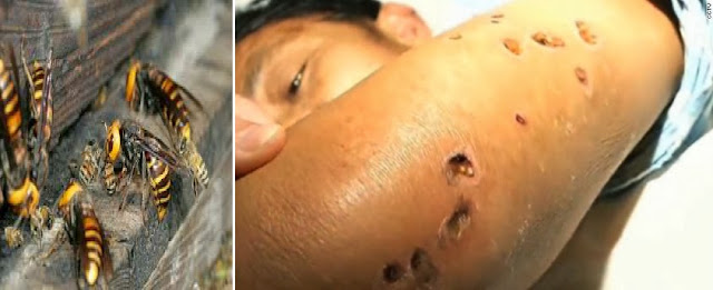 Tony Nwajei Post Deadly Giant Hornets Kill 42 People In China