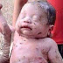 MILAGRE: BEBÊ SOBREVIVE DEPOIS DE SER ESFAQUEADO 14 VEZES E SER ENTERRADO VIVO PELA PRÓPRIA MÃE