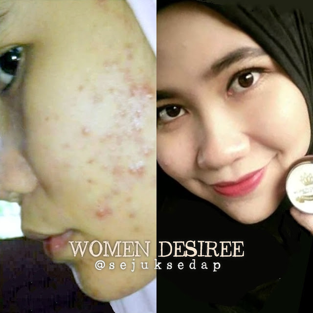 ainaa serum ainaa serum