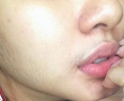 9 Cara Efektif Menghilangkan Bulu di Wajah Tanpa Efek Samping