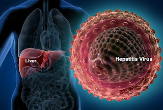 Mengenal Hepatitis E Mengenal Hepatitis E
