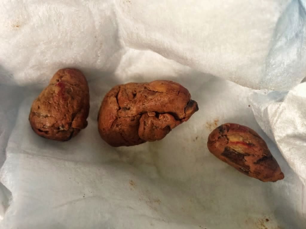 Baby Poop Sausages Is Good For Your Health, Scientists Say Cool