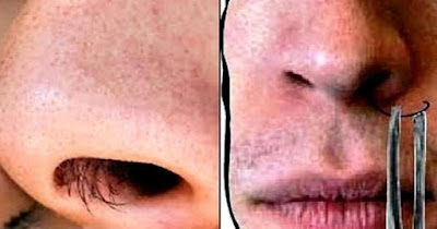 Jangan Cabut Bulu Hidung, Nanti Bisul Loh! Jangan Cabut Bulu Hidung, Nanti Bisul Loh!