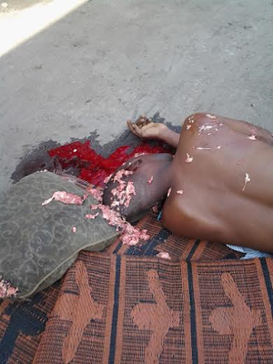 3 Graphic Photos: Fuel Truck crushes the head of a man sleeping under it