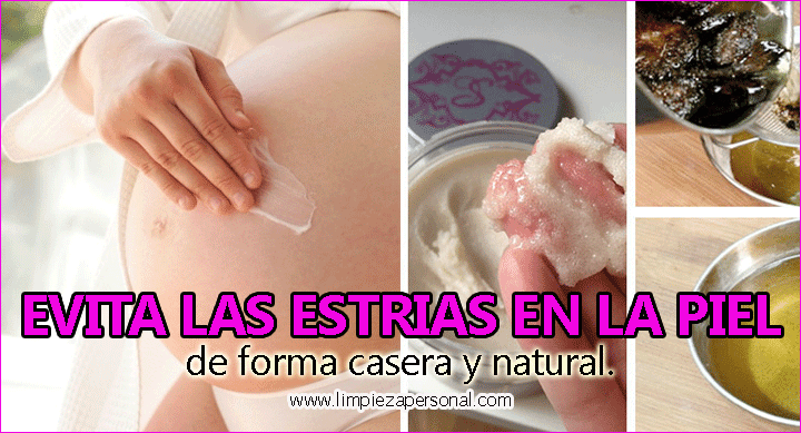 como prevenir estrias en el embarazo de forma natural como prevenir estrias en el embarazo de forma natural