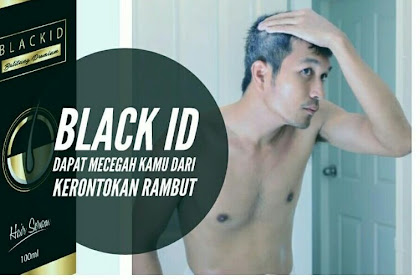 Wow Agen Minyak Uban Kayu Balitung Black Id Premium Belitung