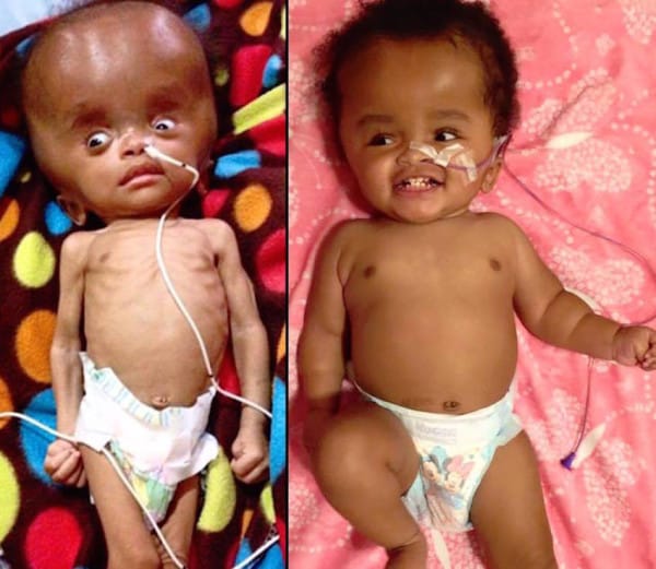 Woman Saw This Poor Baby Abandoned In A Pile Of Trash.. After Two Years, This Is How She Looks Like Now! Woman Saw This Poor Baby Abandoned In A Pile Of Trash.. After Two Years, This Is How She Looks Like Now!