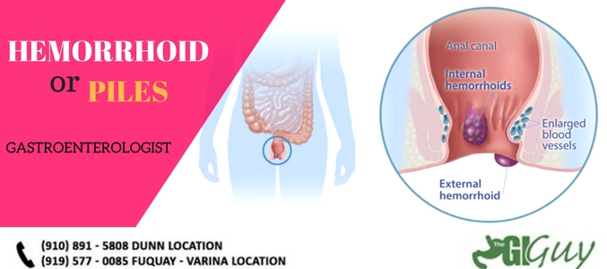 Gastroenterologist Durham NC Gastroenterologist Durham NC