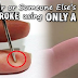 THIS Is Why You Should Always Have A Needle In Your Pocket !