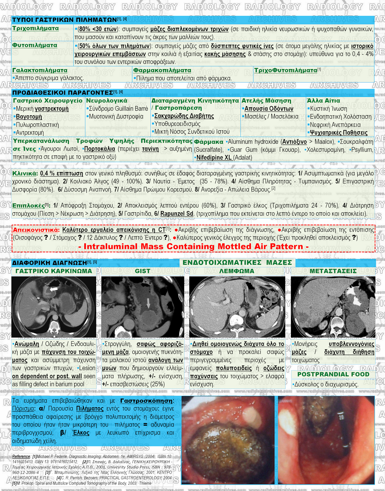 Radiology Archives: Case n. 0018 - Πίλημα Στομάχου (Bezoar)