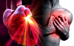 Infarto al corazón Infarto corazón miocardio