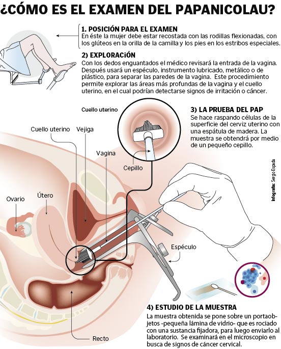 El Examen Se Puede Hacer Papanicolau Si Estas Embarazada