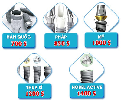 tư vấn cấy ghép răng implant -9 tư vấn cấy ghép răng implant -9