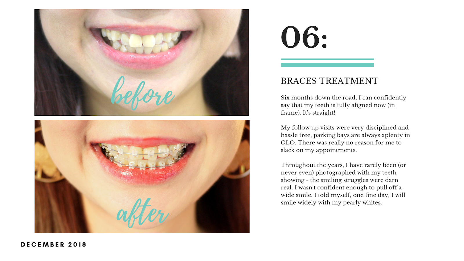 dental clinic in damansara pj ttdi kl 32 pearls dental clinic review