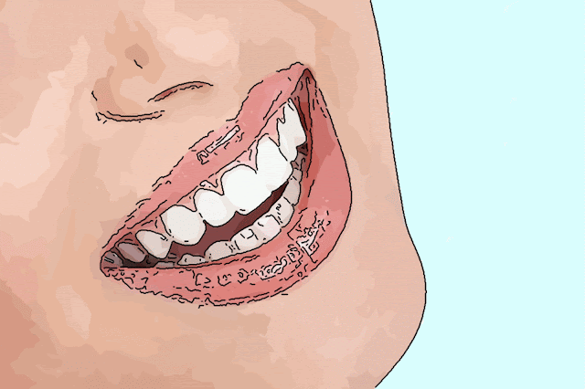 When will the numbness behind your front teeth go away? - Why do your teeth hurt after a nose surgery? - Tooth numbness after septoplasty - Upper teeth numbness after rhinoplasty - Nasopalatine nerve - When does drowsiness disappear after nose surgery? - Numbness after nose surgery - Numbness in the upper teeth after nose surgery - Numbness in the upper teeth after septoplasty surgery