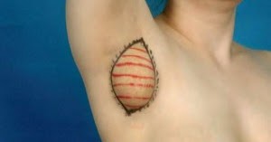 veias mamárias inchadas