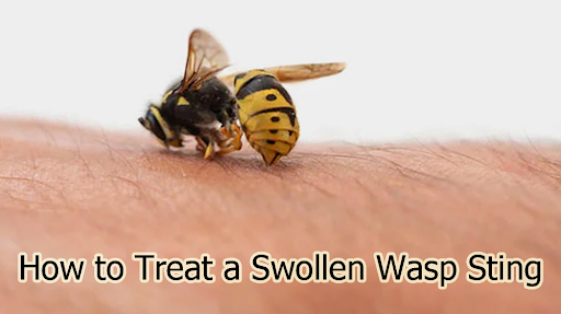 How to Treat a Swollen Wasp Sting