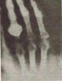 First Radiograph
