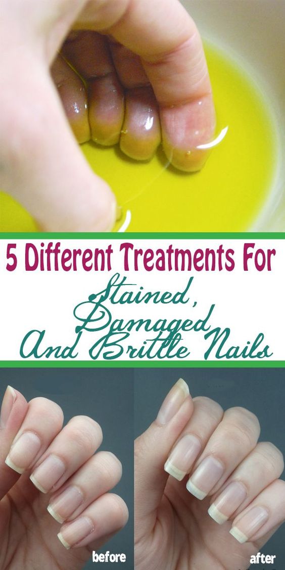 Home Remedies To Get Strong Nails