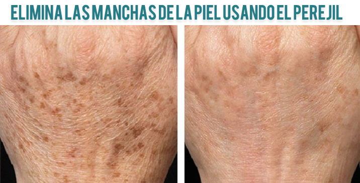 Como hacer el maquillaje cuando la muchacha con las pecas