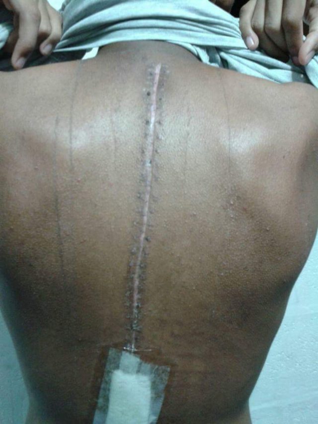 Obasa's blog STOP! THE EFFECT OF CARRYING HEAVY BAG ON CHILDREN'S BACK