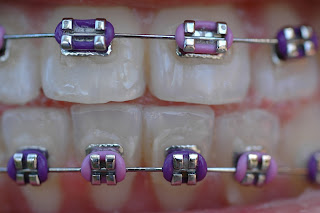 Brackets John A Gerling DDS in McAllen TX