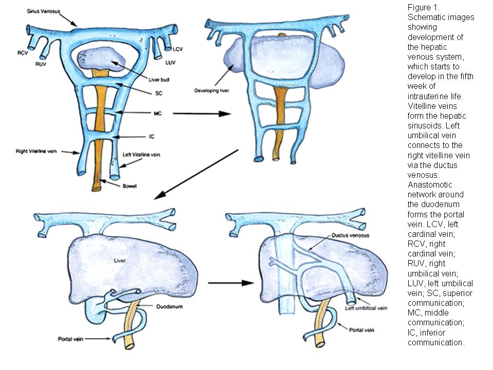 BÀI SOẠN VỀ SIÊU ÂM CHẨN ĐOÁN Hepatic Vascular Shunts