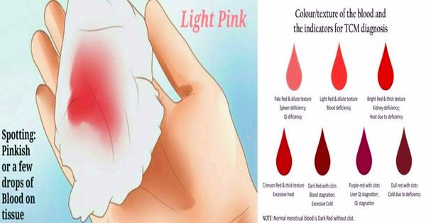 light menstrual bleeding