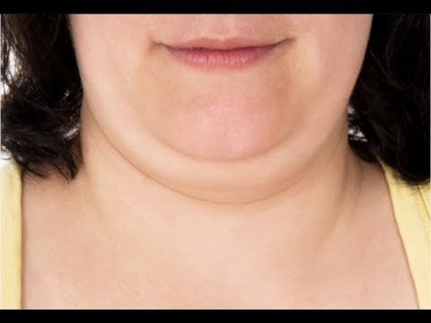 4+Tips+To+Lose+Double+Chin+Fat+Quickly++
