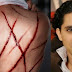 خبيرة طبية: الجلد المتكرر للمدوِّن السعودي قد يتسبب بأضرار طويلة الأجل