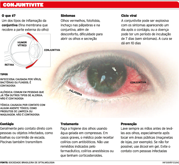 Conjuntivite bacteriana e contagiosa