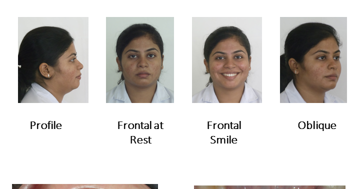 Dentosphere : World of Dentistry: Photographs in Orthodontics - Dental ...