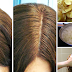 POTATO PEEL: Makatutulong Para Alisin Ang Gray Hair At White Hair Naturally