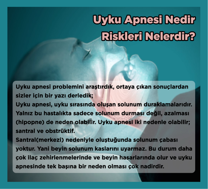 makattan sarkan et parçası nedir