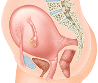 Dolor de utero en embarazo