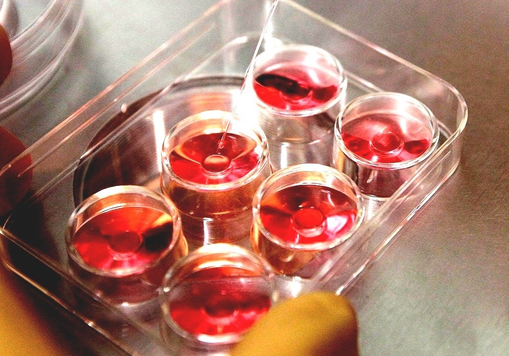 Egg Donation - Harvesting Human Eggs