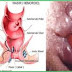 OBAT BAB BERDARAH PADA ANAK thumbnail
